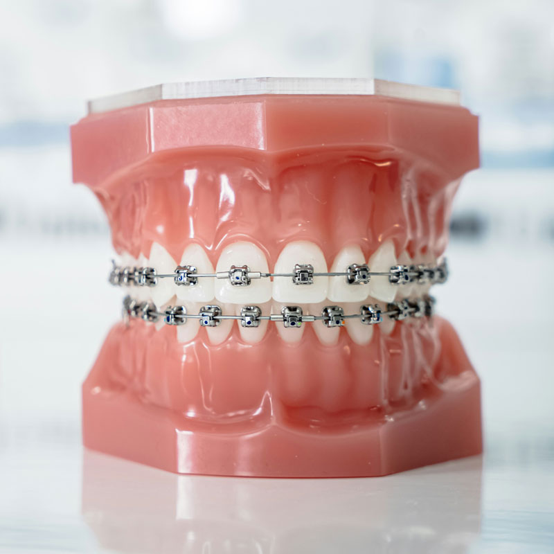 MyOrthoApeldoorn_10